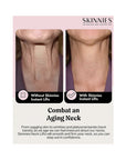 Instant Neck Lift